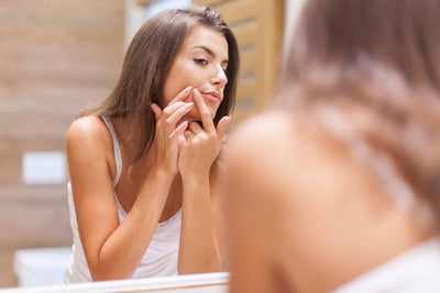 12 Natural Remedies For Acne That Actually Work