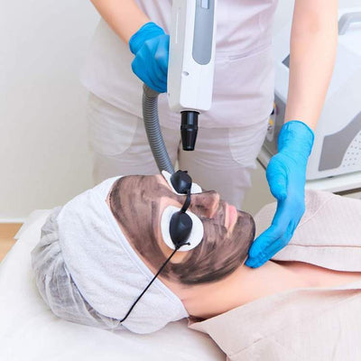 Carbon Laser Peel - Hollywood Facial: Everything you Need to Know