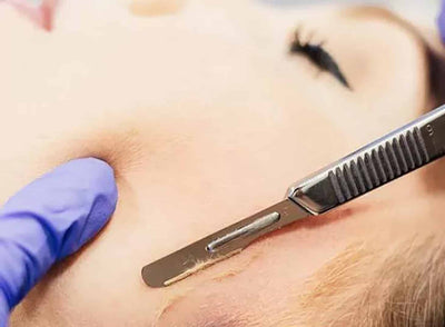 Should I get Dermaplaning treatment? Dermaplaning Pros and Cons