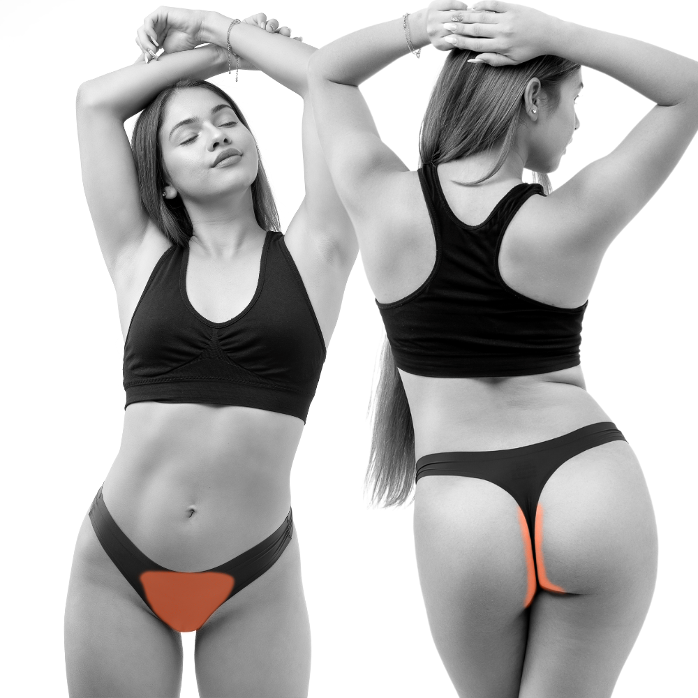 Brazilian bikini laser hair removal deals