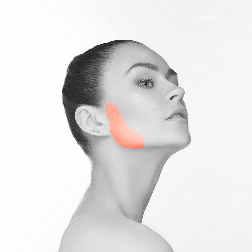 Sideburn Laser Hair Removal for Women in NYC Infinity Laser Spa