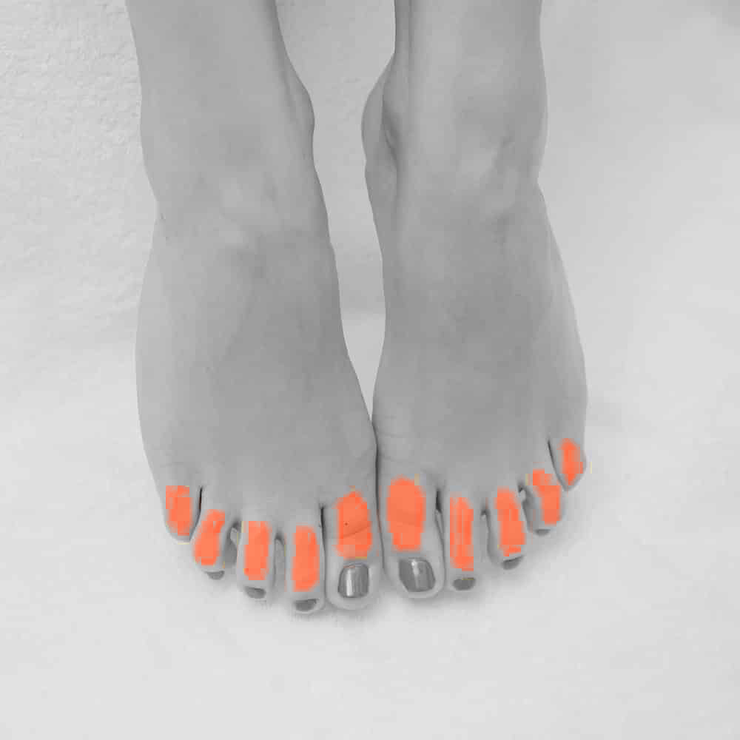 Toes Laser Hair Removal For Women in NYC